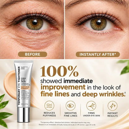 Eye Tightener – Refresh & Revive